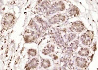 IHC-P - OGDH Polyclonal Antibody AP56804